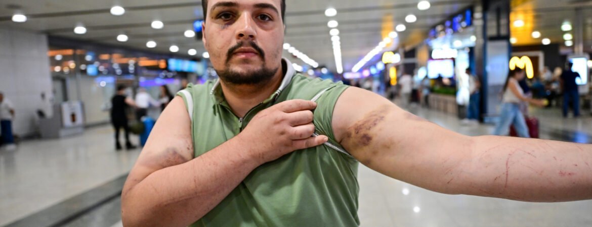 Yurt dışında fidye için kaçırılan Türk vatandaşı İstanbul'a getirildi