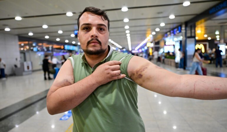 Yurt dışında fidye için kaçırılan Türk vatandaşı İstanbul'a getirildi
