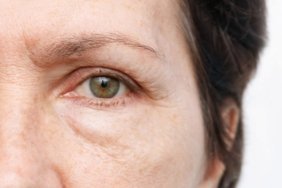 1750658952_goz_alti_sisligi