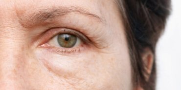 1750658952_goz_alti_sisligi