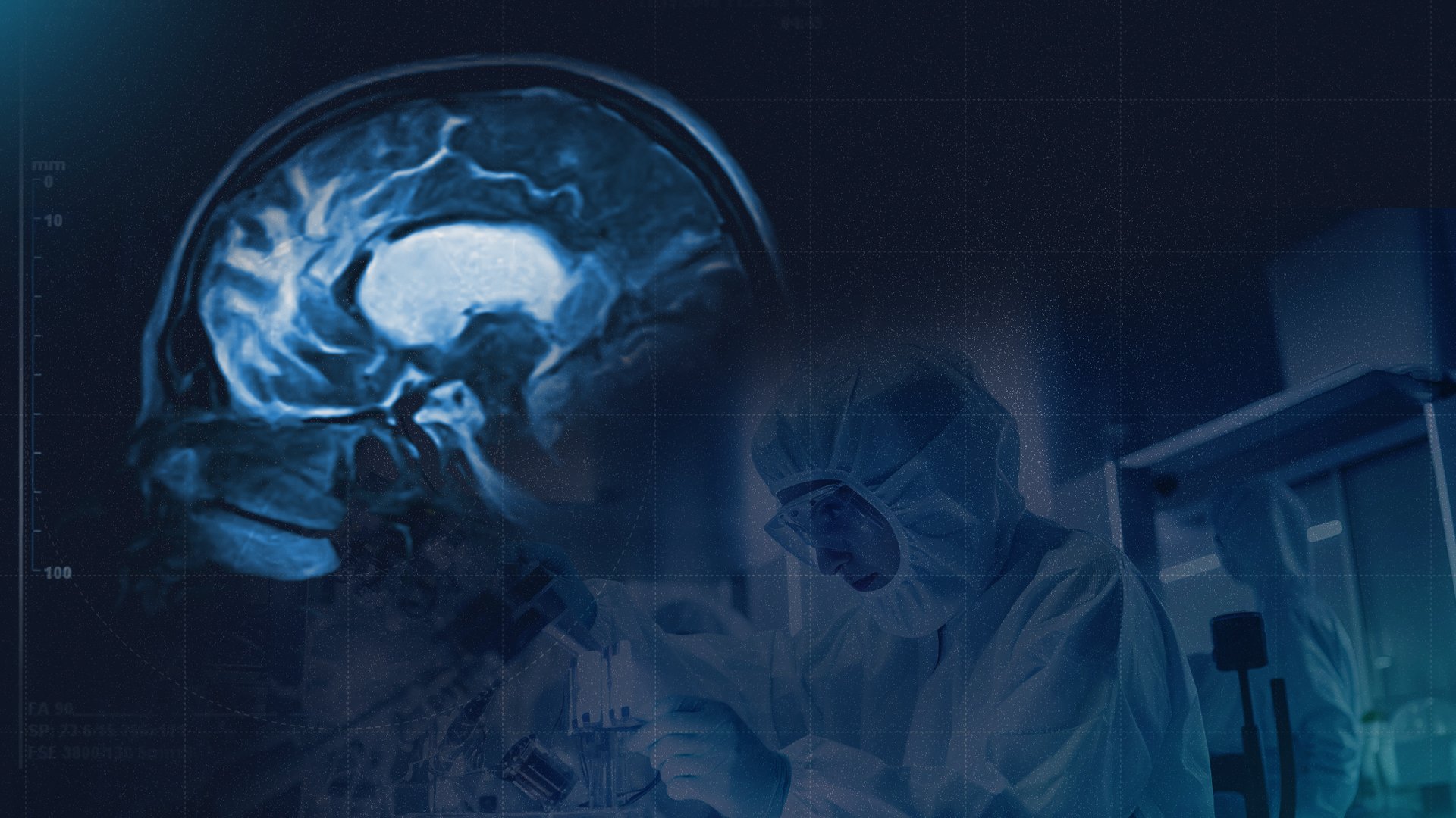 1753646124 Alzeheimer 25.07.2025 bg