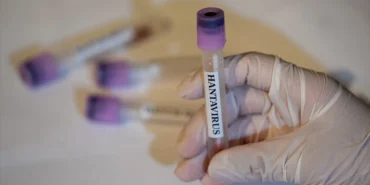 AA-20260513-41367053-41367052-AVRUPA_ILAC_AJANSI_HANTAVIRUS_ICIN_ONAYLI_TEDAVI_VE_ASI_YOK